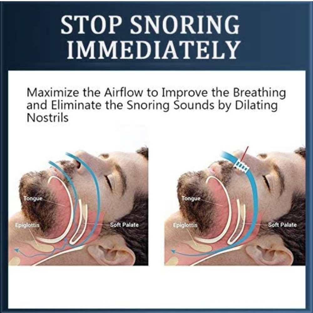 snoring device